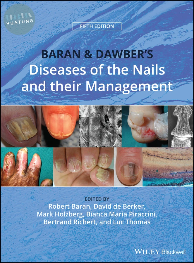Baran and Dawber's Diseases of the Nails and their Management 