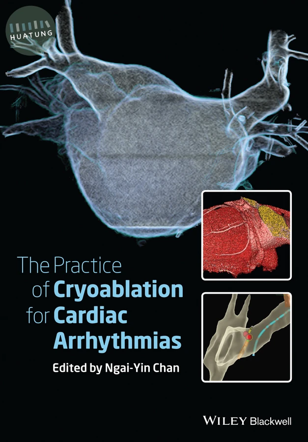 The Practice of Catheter Cryoablation for Cardiac Arrhythmias 