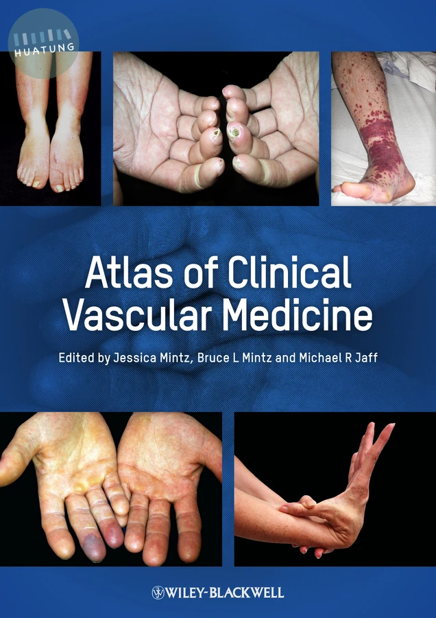 Atlas of Clinical Vascular Medicine 