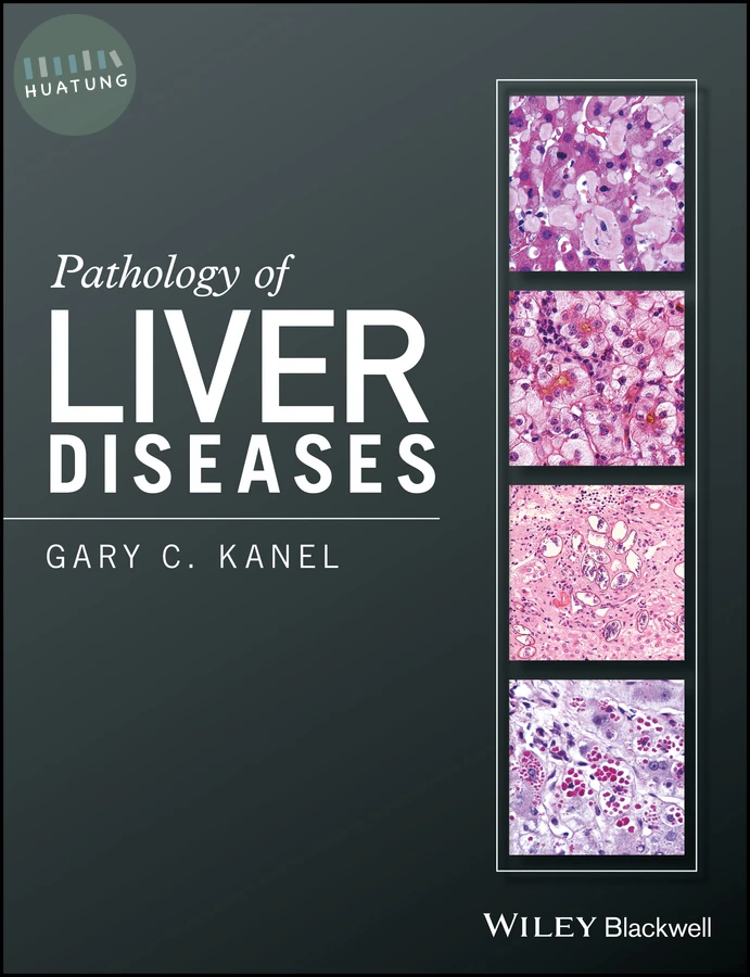 Pathology of Liver Diseases 