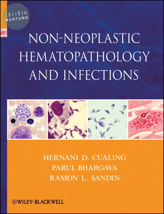 Non-Neoplastic Hematopathology and Infections 