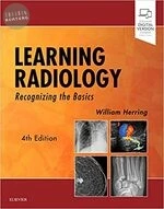 Learning Radiology: Recognizing the Basics (4版)