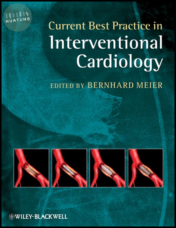 Current Best Practice in Interventional Cardiology 
