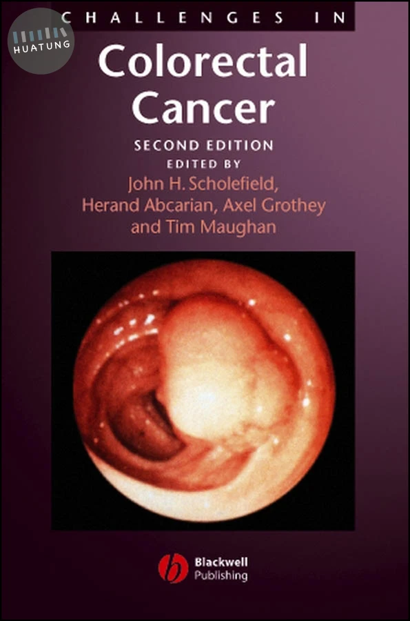Challenges in Colorectal Cancer 