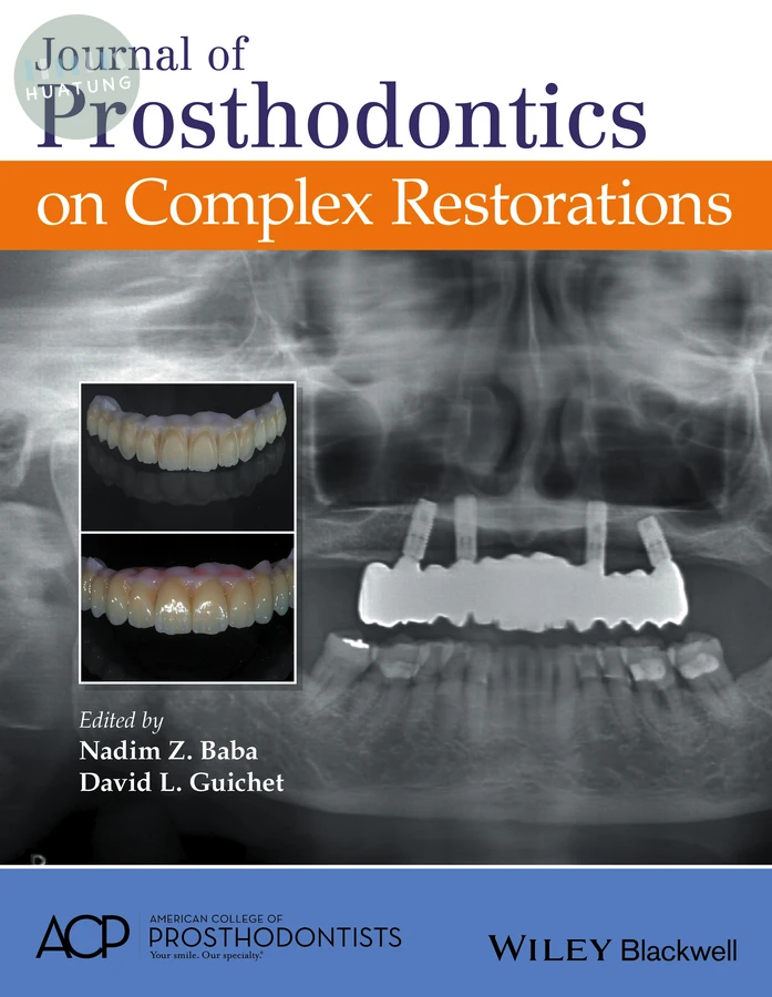 Journal of Prosthodontics on Complex Restorations 