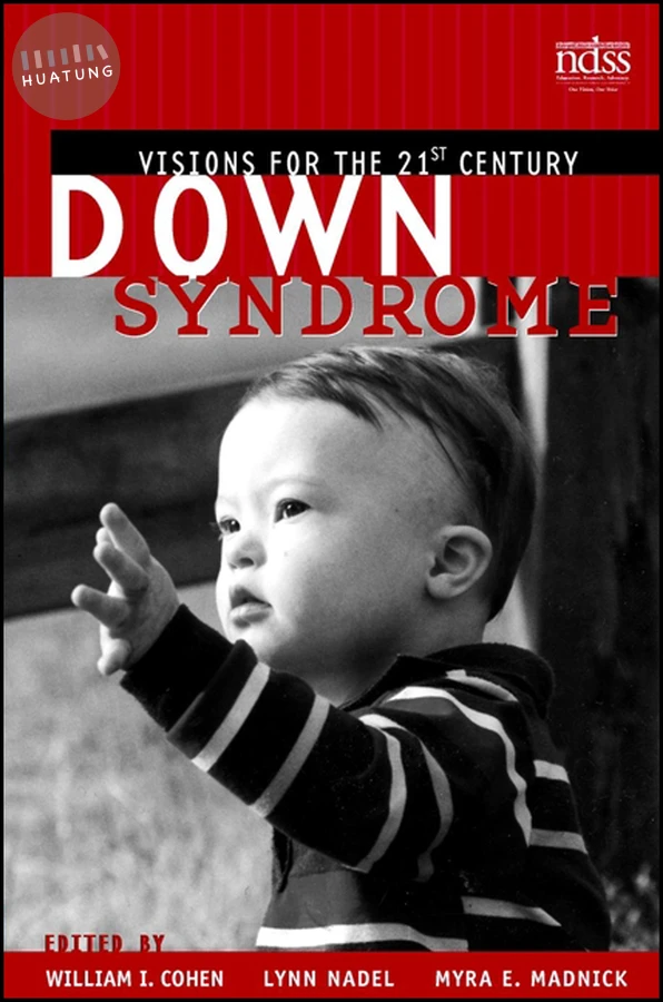 Down Syndrome 