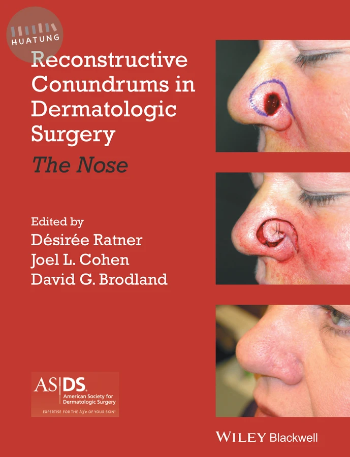 Reconstructive Conundrums in Dermatologic Surgery 