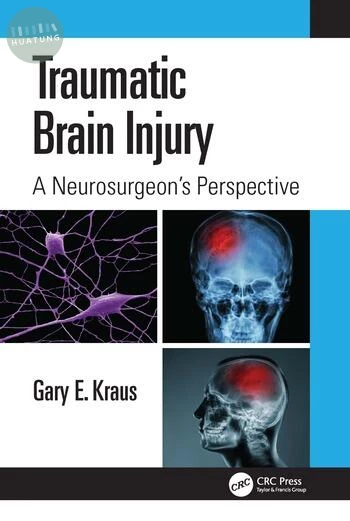 Traumatic Brain Injury: A Neurosurgeon's Perspective (1版)
