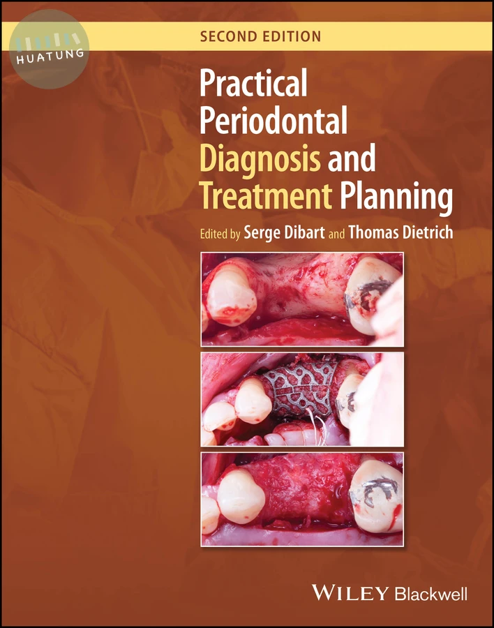 Practical Periodontal Diagnosis and Treatment Planning 
