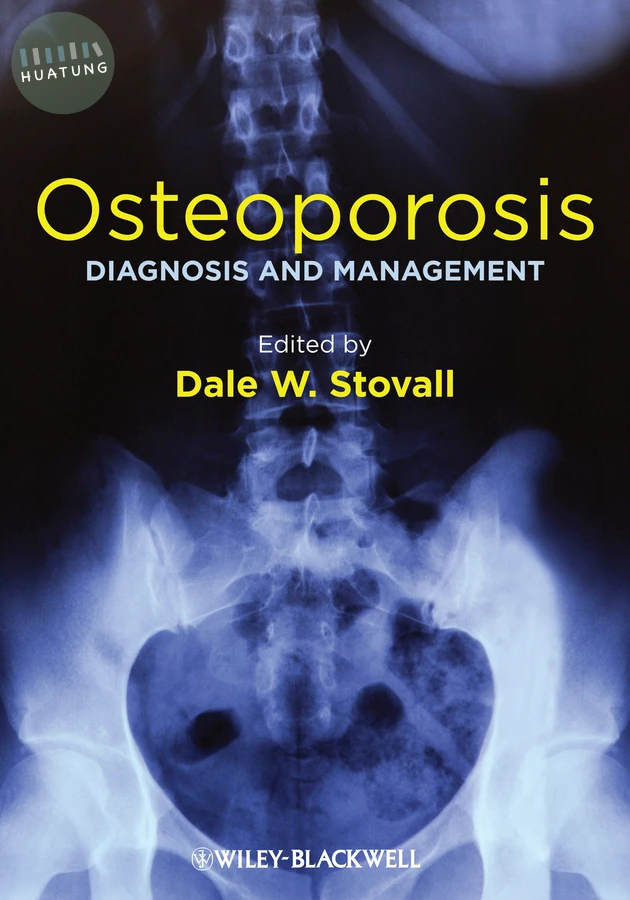 Osteoporosis 