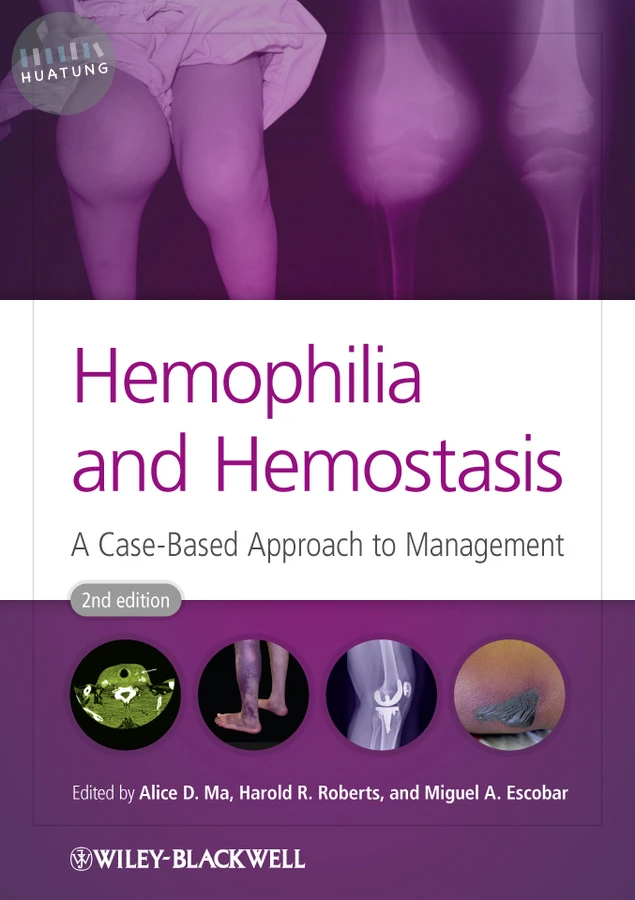 Hemophilia and Hemostasis 