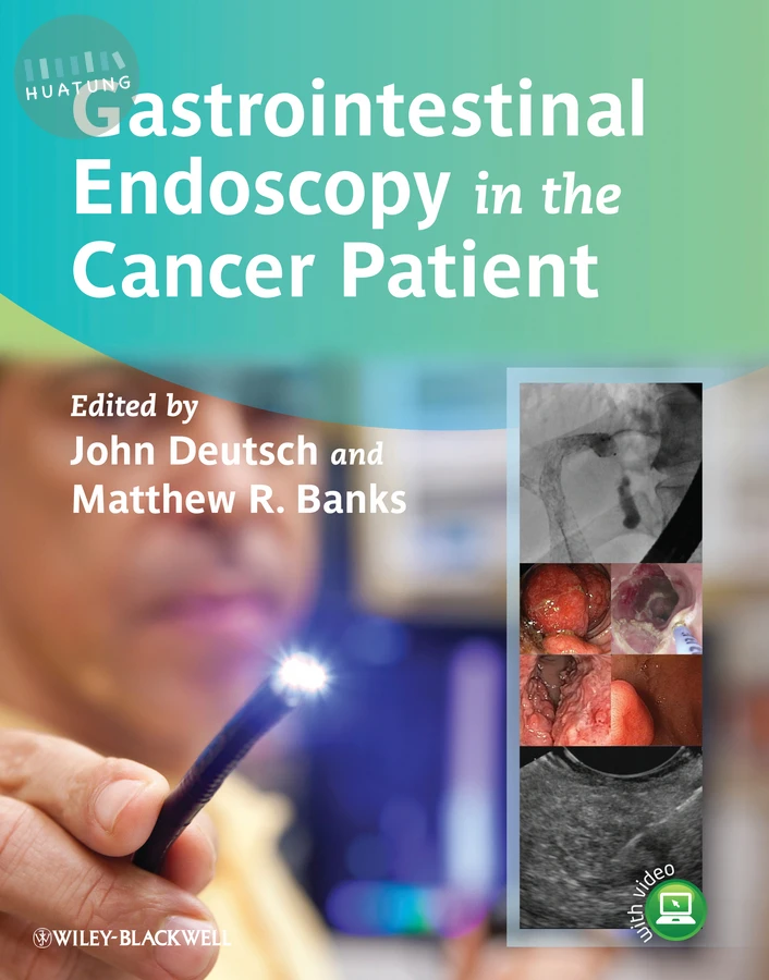 Gastrointestinal Endoscopy in the Cancer Patient 