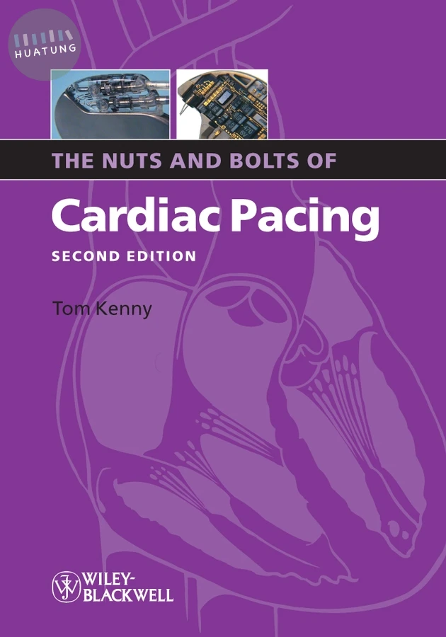 The Nuts and Bolts of Cardiac Pacing 
