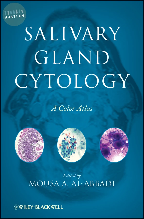 Salivary Gland Cytology 