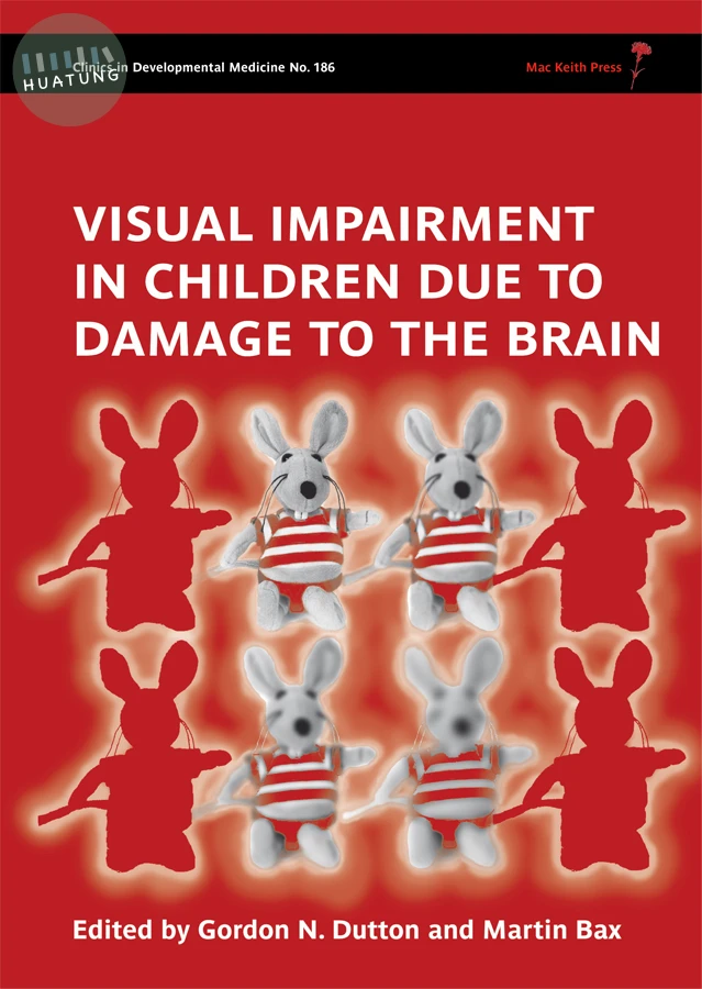 Visual Impairment in Children due to Damage to the Brain 