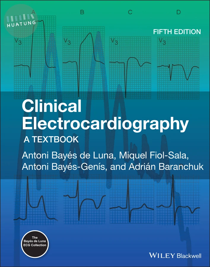 Clinical Electrocardiography 