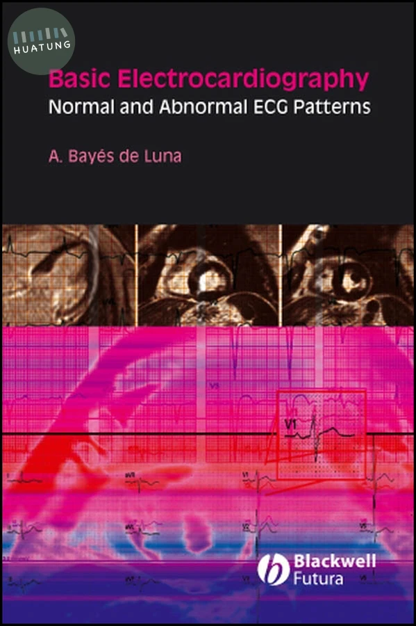 Basic Electrocardiography 