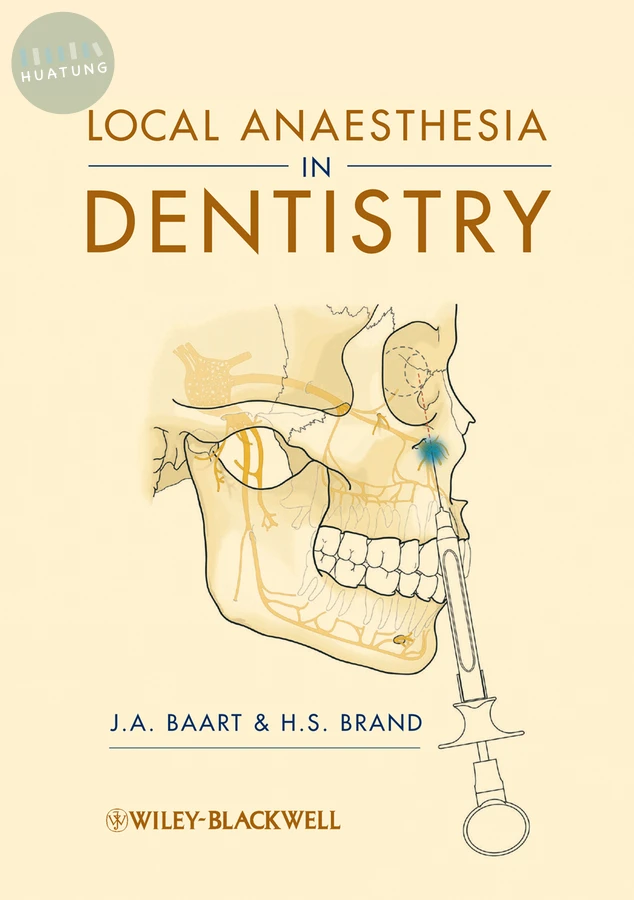Local Anaesthesia in Dentistry 