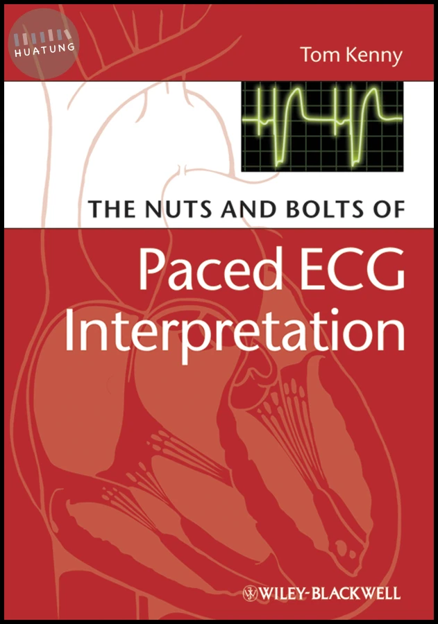 The Nuts and bolts of Paced ECG Interpretation 