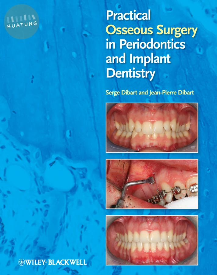 Practical Osseous Surgery in Periodontics and Implant Dentistry 