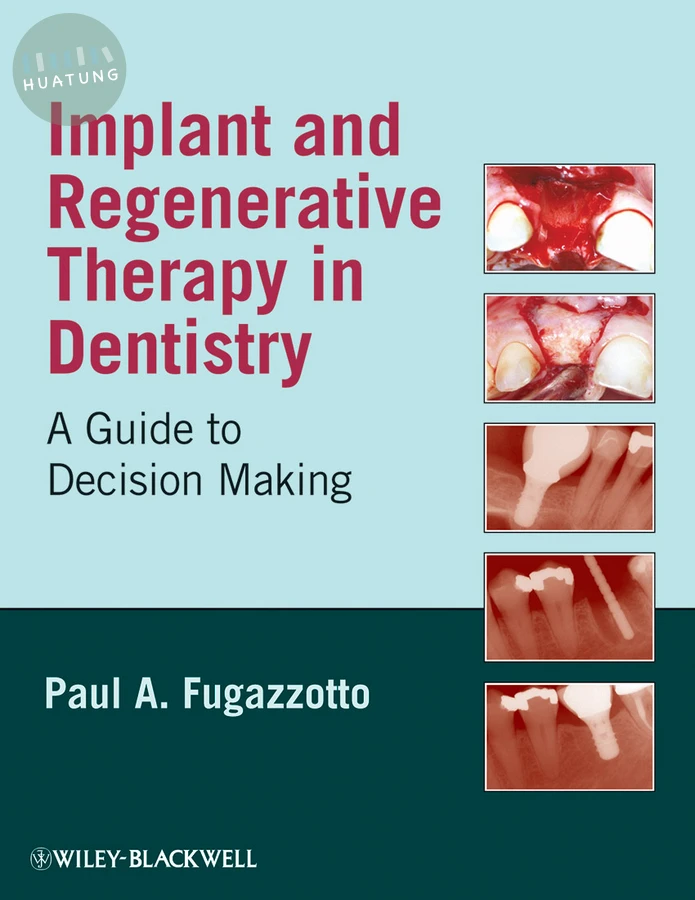 Implant and Regenerative Therapy in Dentistry 