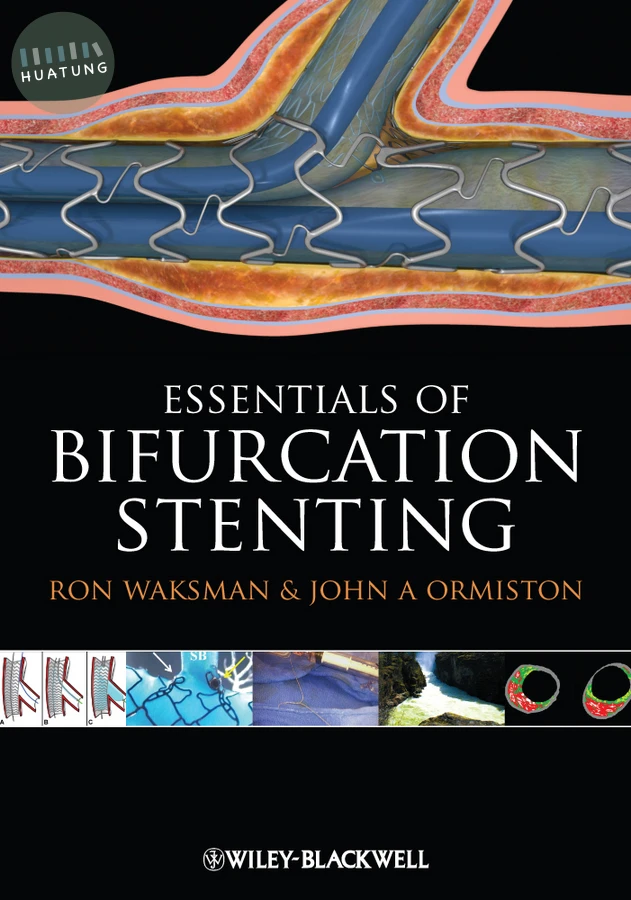 Bifurcation Stenting 