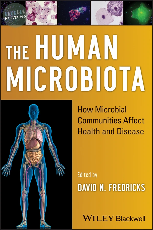 The Human Microbiota 