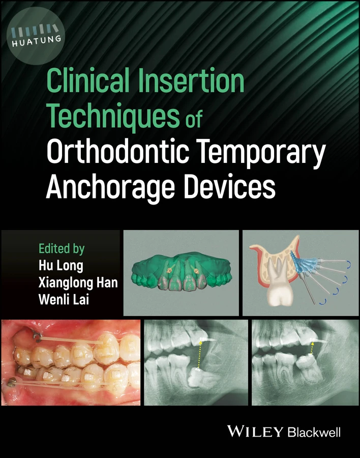 Clinical Insertion Techniques of Orthodontic Temporary Anchorage Devices 