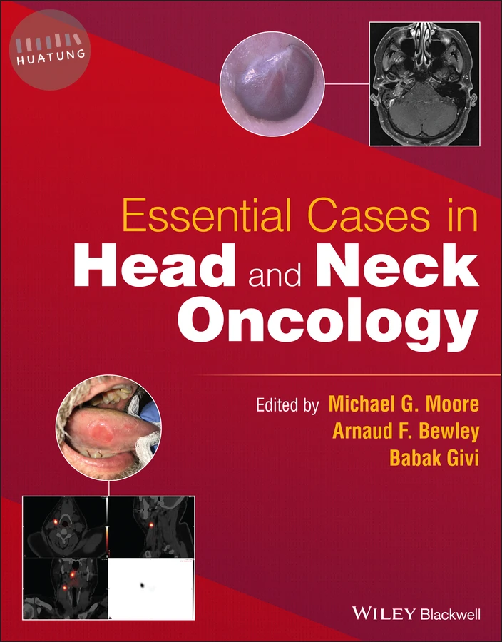 Essential Cases in Head and Neck Oncology 