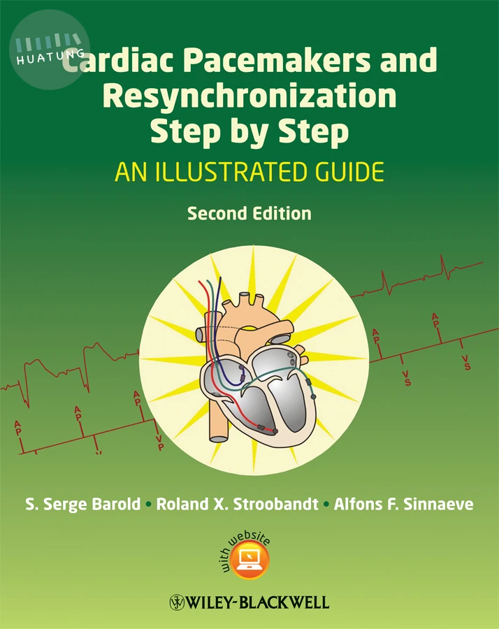 Cardiac Pacemakers and Resynchronization Step by Step 