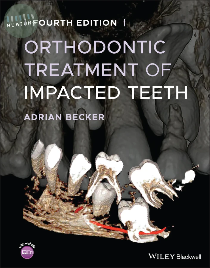 Orthodontic Treatment of Impacted Teeth 