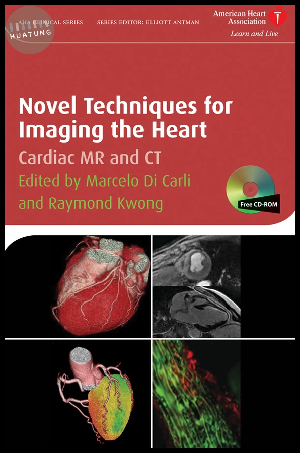 Novel Techniques for Imaging the Heart 