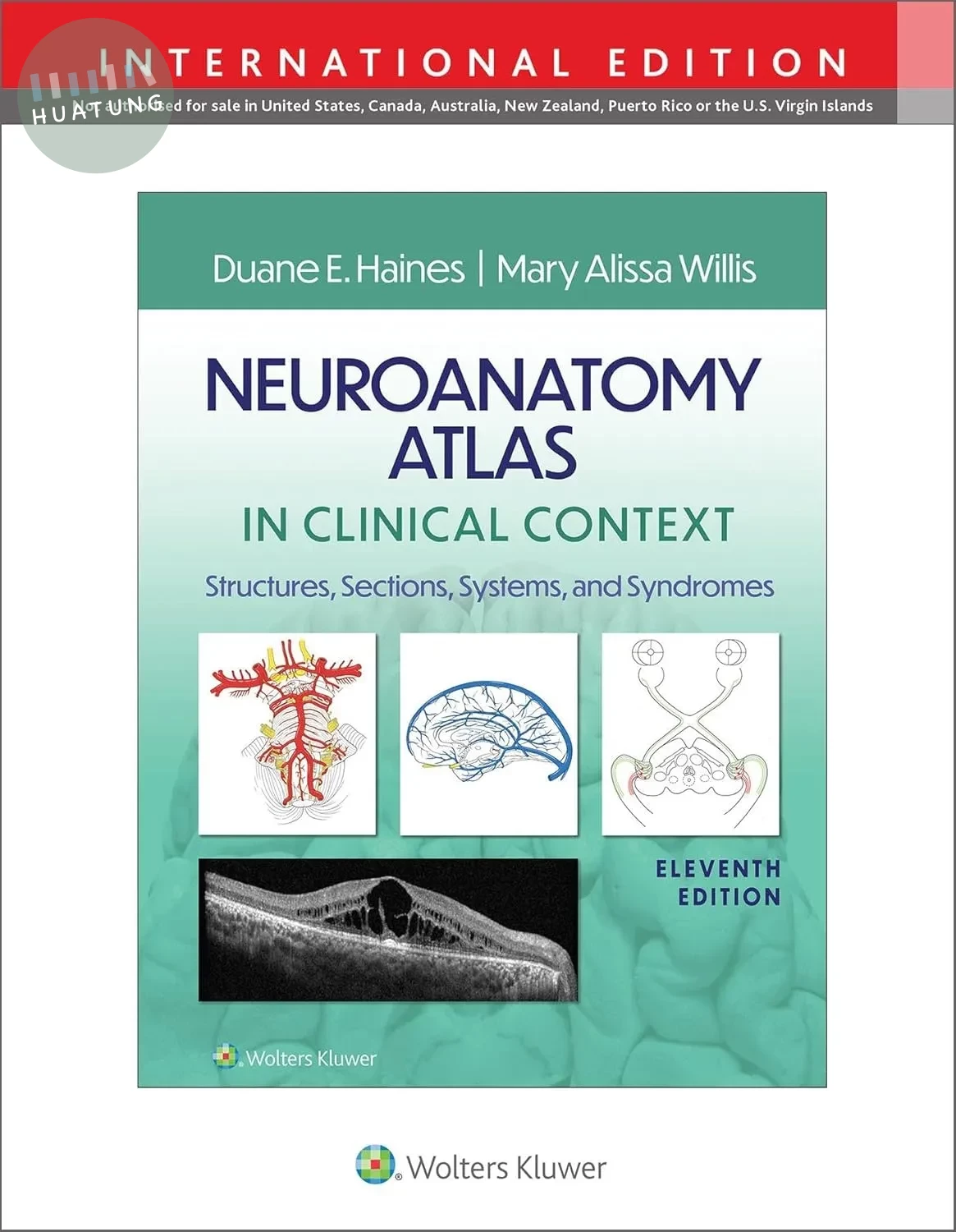 Neuroanatomy Atlas in Clinical Context:Structures, Sections, Systems, and Syndromes 