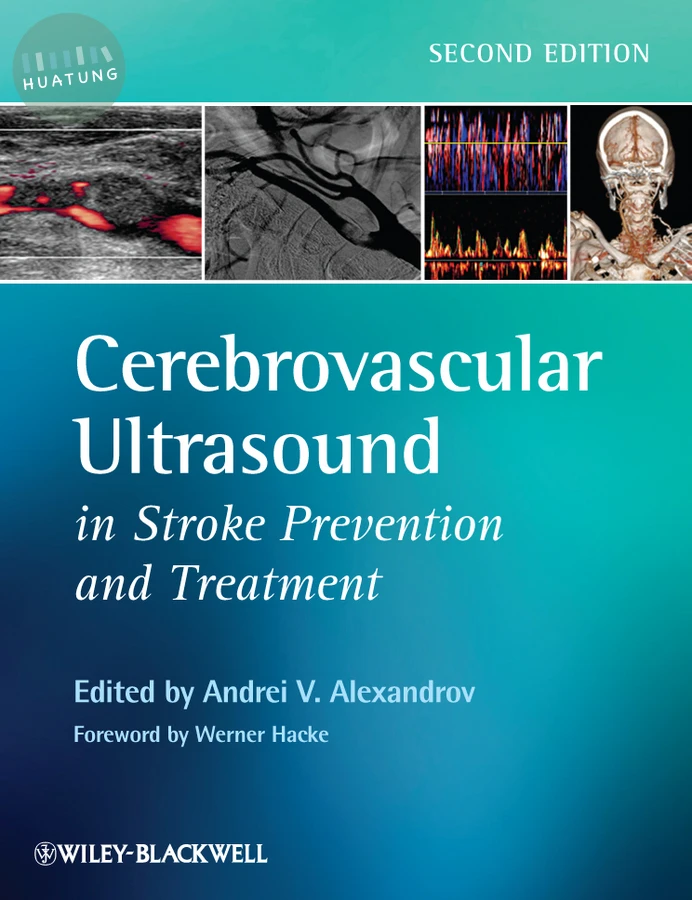 Cerebrovascular Ultrasound in Stroke Prevention and Treatment 