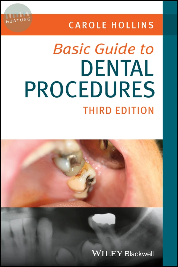 Basic Guide to Dental Procedures 
