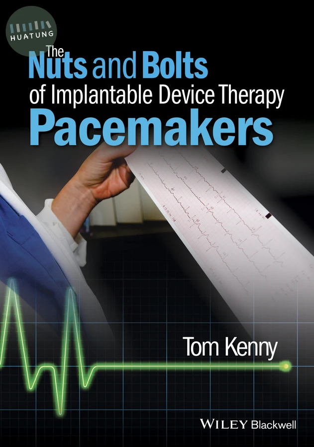 The Nuts and Bolts of Implantable Device Therapy 
