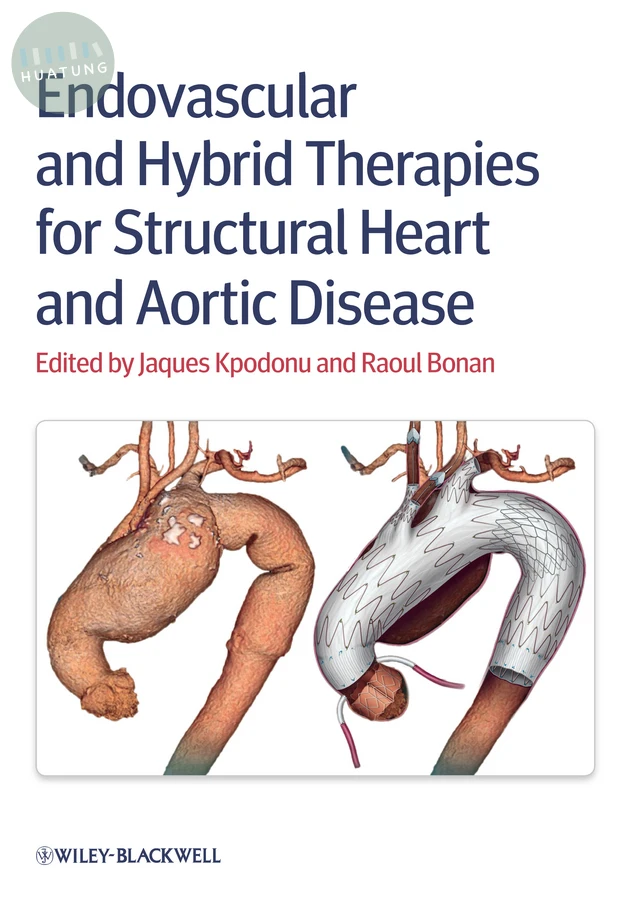 Endovascular and Hybrid Therapies for Structural Heart and Aortic Disease 