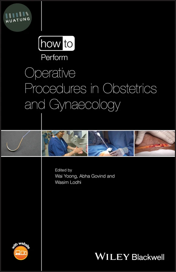How to Perform Operative Procedures in Obstetrics and Gynaecology 