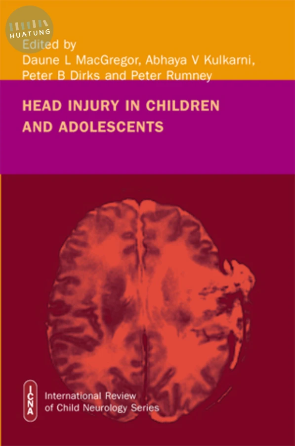 Head Injury in Childhood and Adolescence 