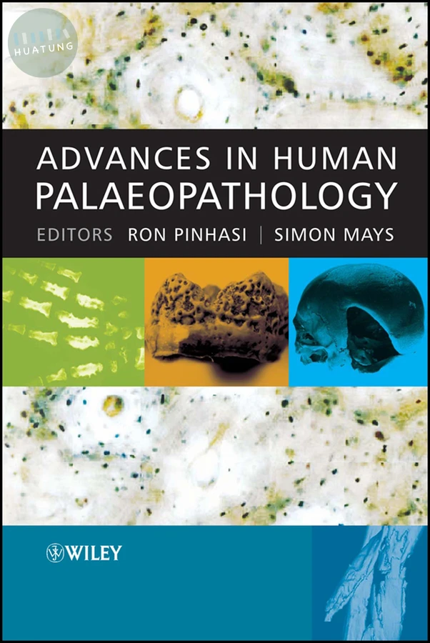 Advances in Human Palaeopathology 