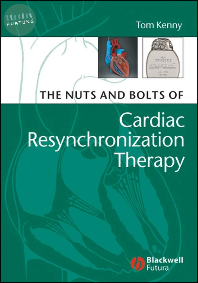 The Nuts and Bolts of Cardiac Resynchronization Therapy 