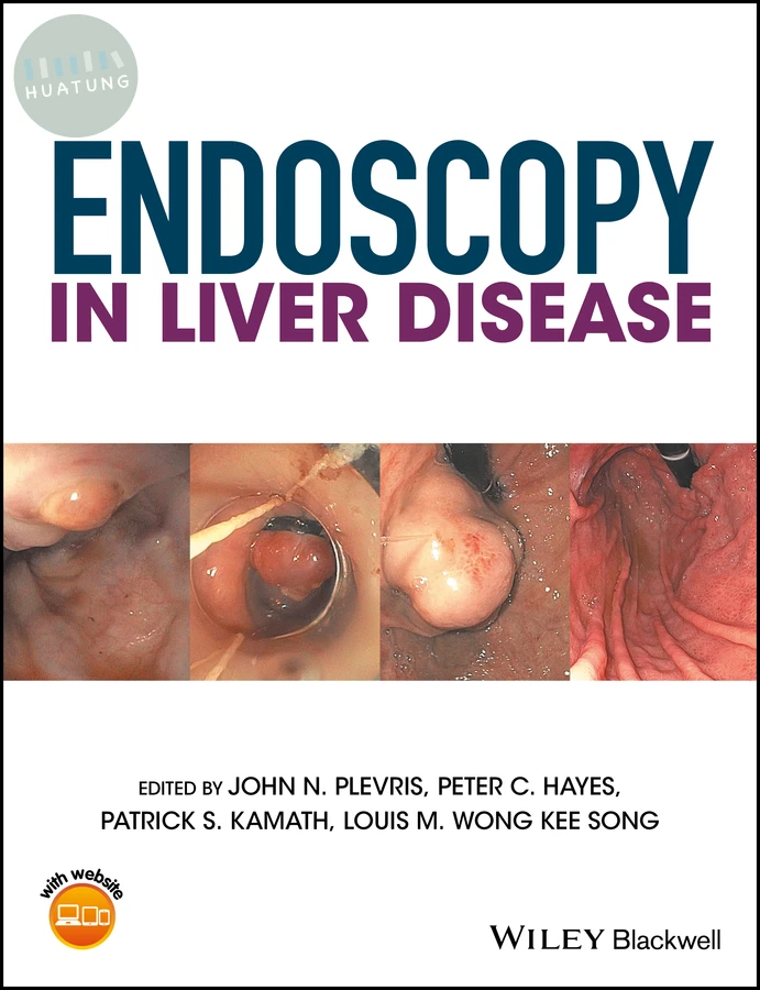 Endoscopy in Liver Disease 