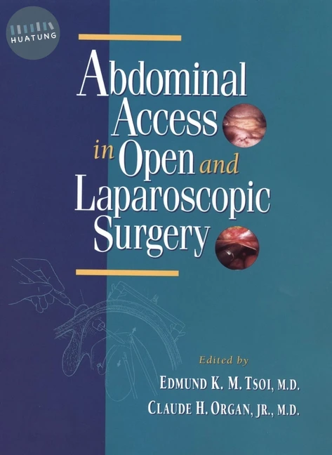 Abdominal Access in Open and Laparoscopic Surgery 