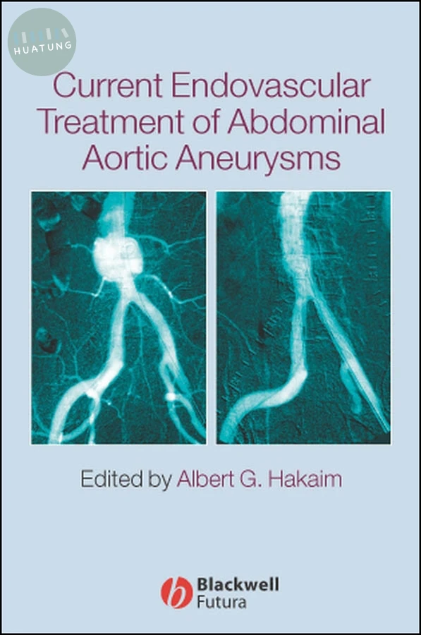 Current Endovascular Treatment of Abdominal Aortic Aneurysms 