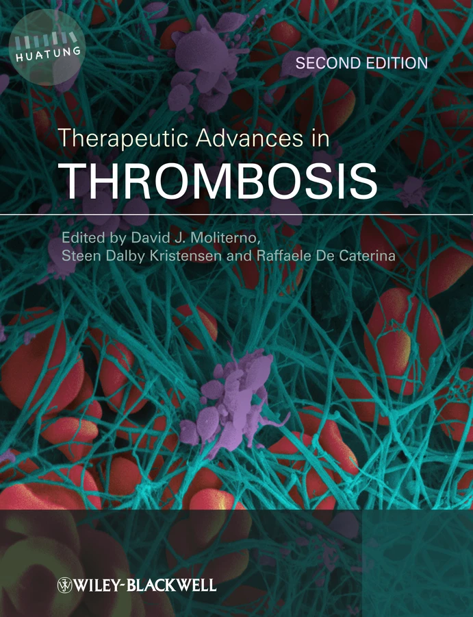 Therapeutic Advances in Thrombosis 
