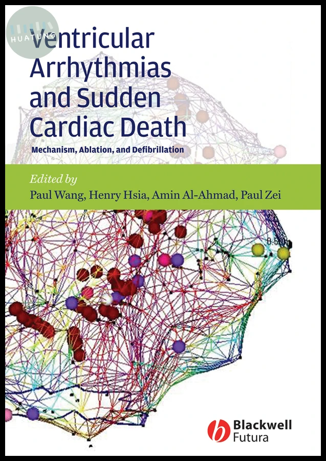 Ventricular Arrhythmias and Sudden Cardiac Death 