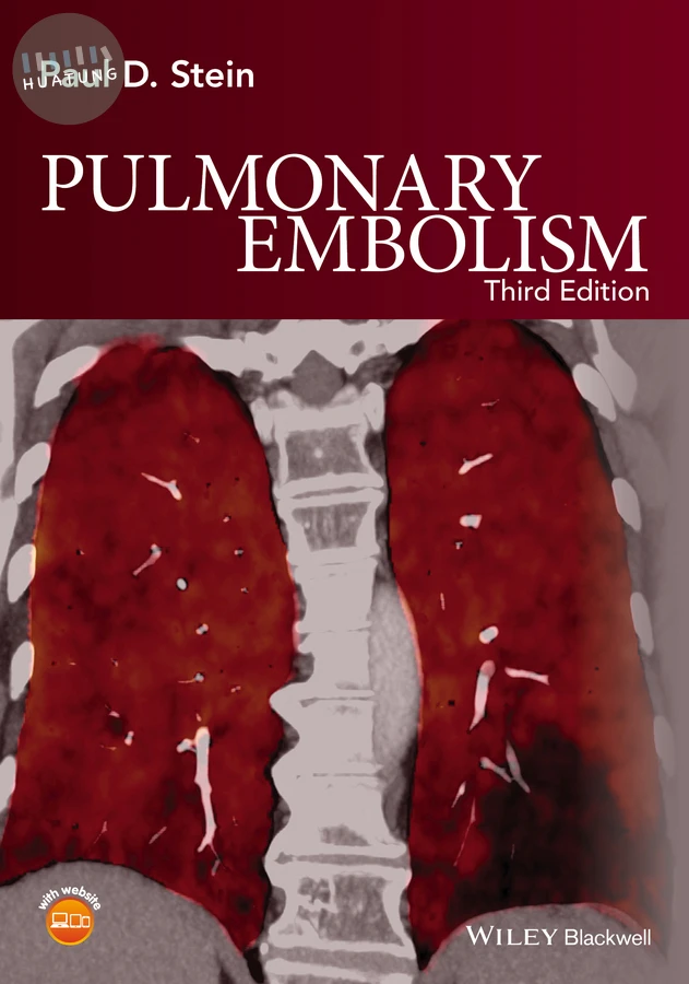 Pulmonary Embolism 