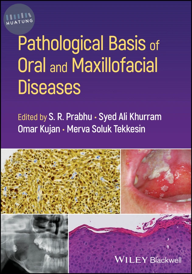 Pathological Basis of Oral and Maxillofacial Diseases 