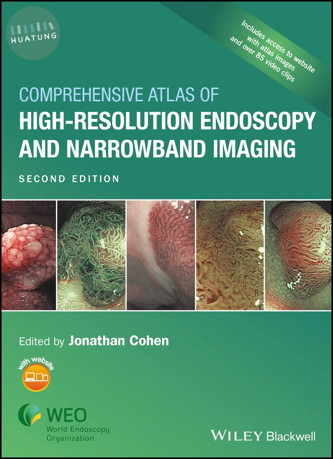 Comprehensive Atlas of High-Resolution Endoscopy and Narrowband Imaging 