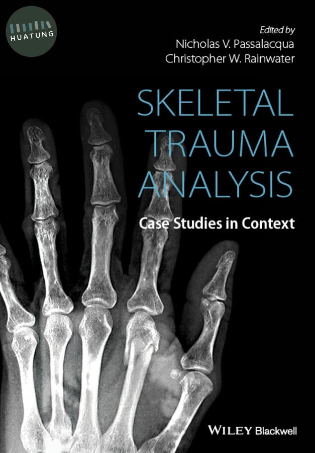Skeletal Trauma Analysis 
